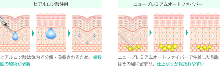 治療イメージ