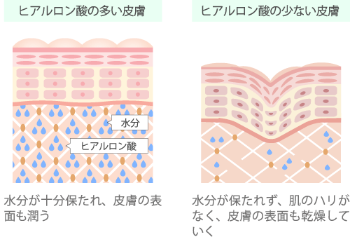 ヒアルロン酸の多い皮膚・少ない皮膚