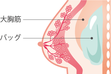 大胸筋・バッグ