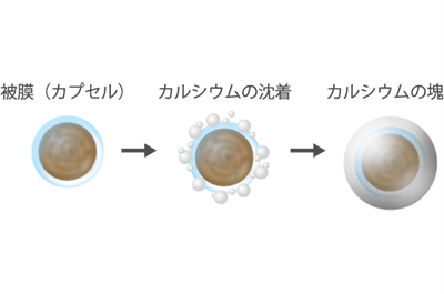 しこりとは