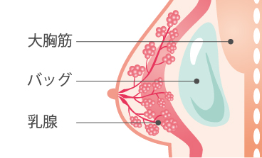 挿入位置