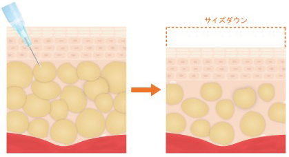 施術イメージ