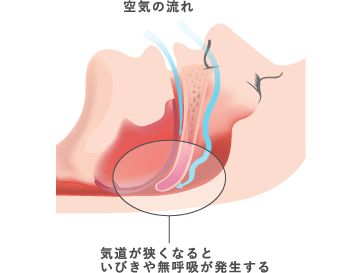 空気の流れ