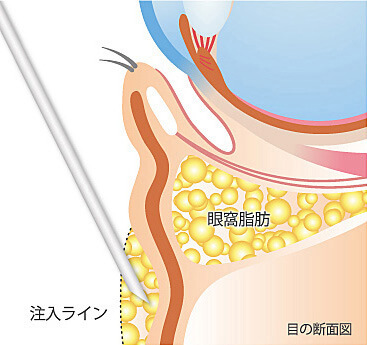 目の断面図