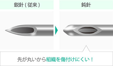 カニューレ先端