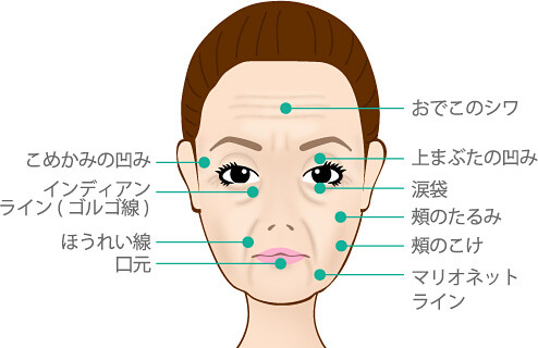 悩みの部位