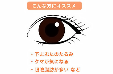 下まぶたのたるみ、クマが気になる、眼窩脂肪が多い、など