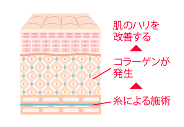 コラーゲンが肌のハリを改善