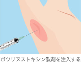注射