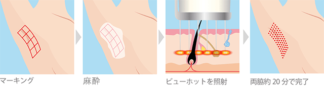 治療イメージ