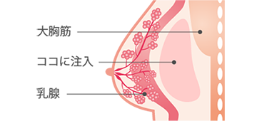 注入部位