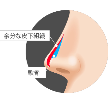 説明