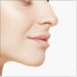 ヒアルロン酸による隆鼻術