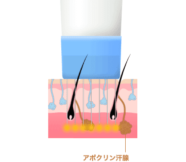 アポクリン汗腺