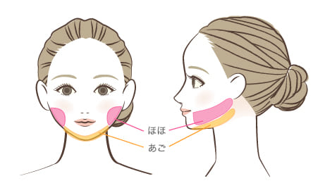 ほほ・顎の脂肪吸引とは