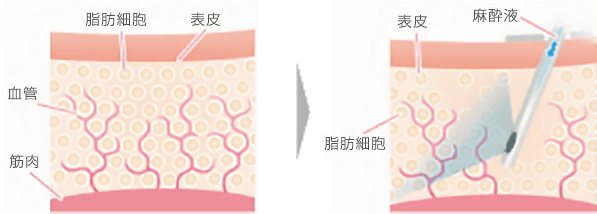 治療イメージ