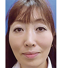 目の下のくま・たるみ治療 術後