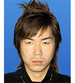 眼の美容整形　術前