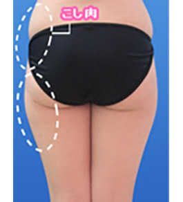 治療前の太もも症例写真