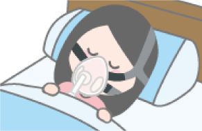 いびき改善法 Cpapのメリットとデメリット ガーデンクリニック 美容整形 美容外科