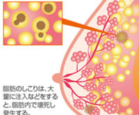 col-breast-017