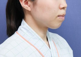 症例写真